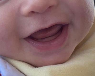 Tiny Teeth, Big Care: How to Keep Your Newborn’s Mouth&nbsp;Healthy